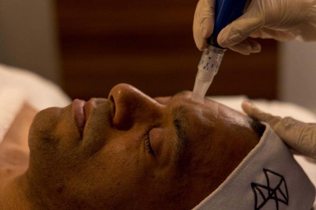 a man getting SkinPen microneedling treatment at pfeffer sal skincare clinic