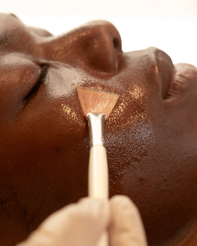 Chemical Peels